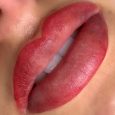 pigmentation-bouche-3d